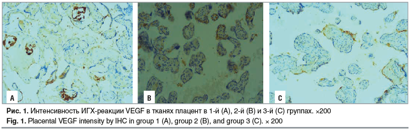 Рис. 1. Интенсивность ИГХ-реакции VEGF в тканях плацент в 1-й (А), 2-й (B) и 3-й (C) группах. ×200 Fig. 1. Placental VEGF intensity by IHC in group 1 (A), group 2 (B), and group 3 (C). × 200